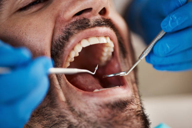 Best Emergency Dentist for Knocked-Out Tooth in Algonquin, MD