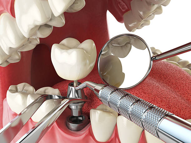 Best Emergency Cosmetic Dentistry in Algonquin, MD